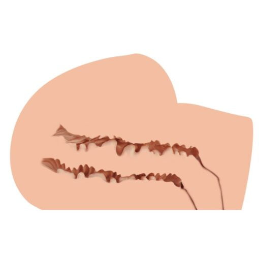 Scarlet Real Hip - Image 6
